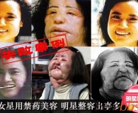 她们带着憧憬去了韩国，整了容，却毁了容