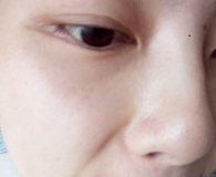 皮肤状态爆照测试